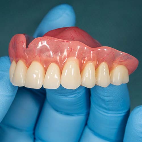 An upper denture in North Naples 