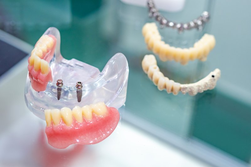 a small plastic model of teeth with mini dental implants inserted