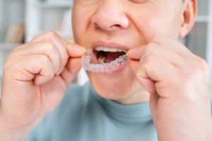 a patient holding their Invisalign aligner